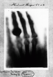 The first X-ray of a human body was that of Wilhelm Roentgen wife's hand in 1895. He won a Nobel Prize in Physics in 1901 for the discovery of the radiograph.